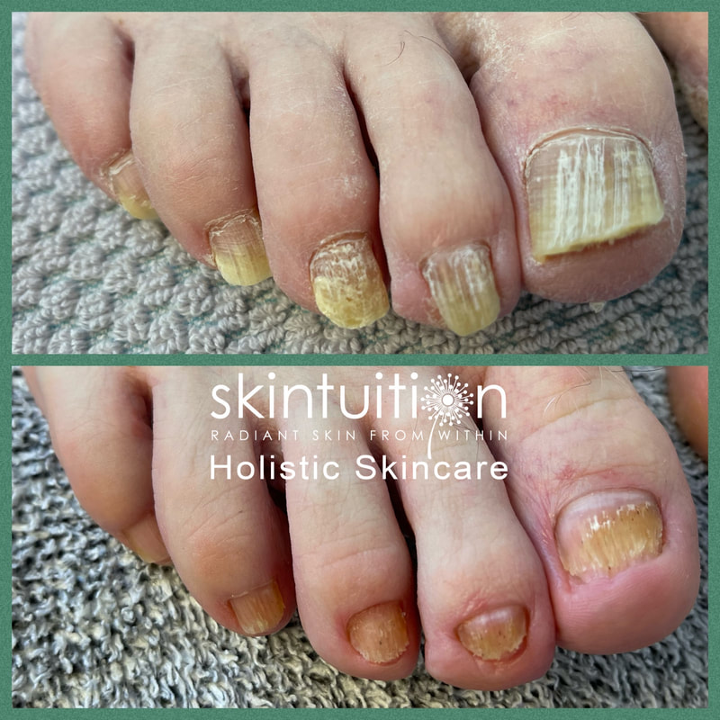 Beautiful Nails the Healthy Way! - SKINTUITION HOLISTIC SKINCARE